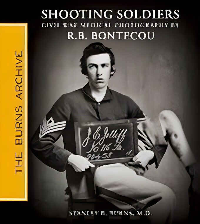 Shooting Soldiers: Civil War Medical Photography By Reed B. Bontecou (SIGNED COPY)by: Stanley B. Burns MD