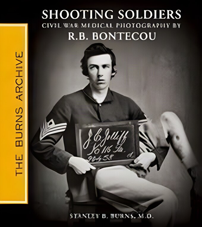 Shooting Soldiers: Civil War Medical Photography By Reed B. Bontecou (SIGNED COPY)by: Stanley B. Burns MD