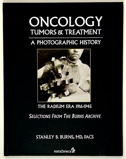 Oncology Tumors &amp; Treatment: A Photographic History 1845-1945 (SIGNED)by: Burns, MD, FACS, Stanley B.
