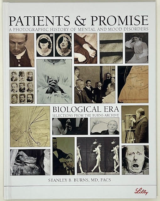 Patients &amp; Promise: A Photographic History of Mental and Mood Disorders, Selections From the Burns Archive (SIGNED)by: Burns, MD, FACS, Stanley B.